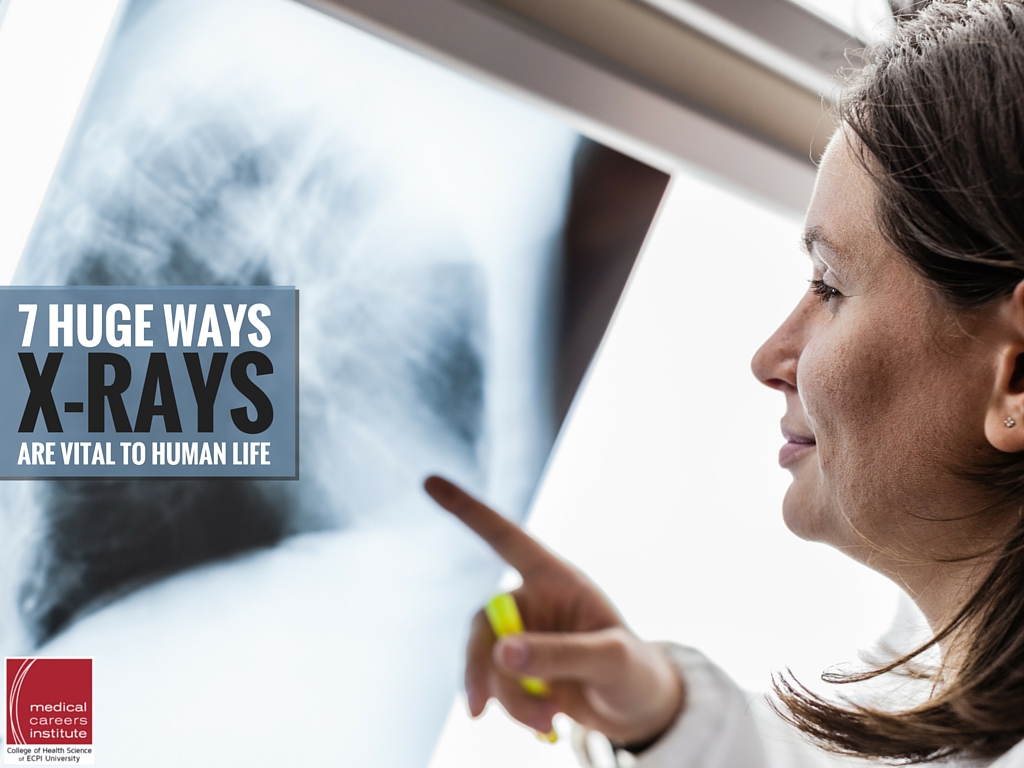 7 Huge Ways Xrays Are Absolutely Vital to Human Life